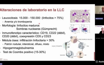 Leucemia linfocítica crónica